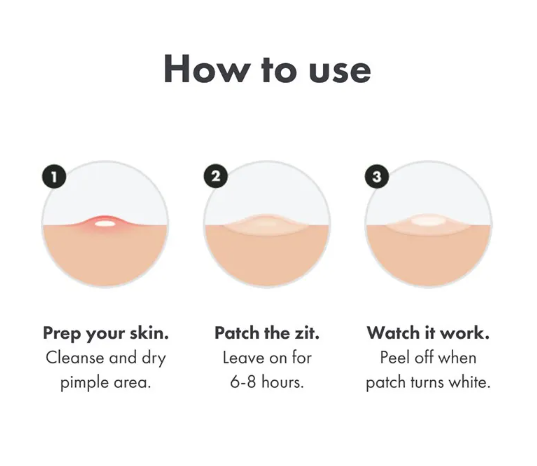 Miracle Chin Acne Repair Patch Day & Night (36/72 Patch Box)